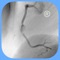 CARDIO3® Atlas of Interventional Cardiology is a  CARDIO3®INVASIVE project – reference/learning tool for cardiologists, cardiac surgeons, internists, other physicians evaluating interventional images in cardiology