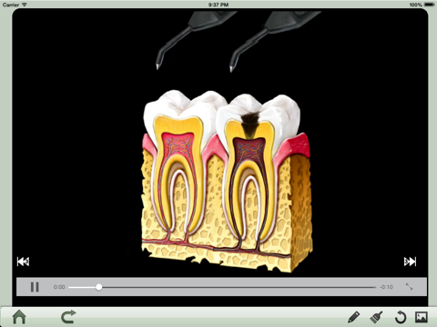 Dental iClinic Lite (J) screenshot 4