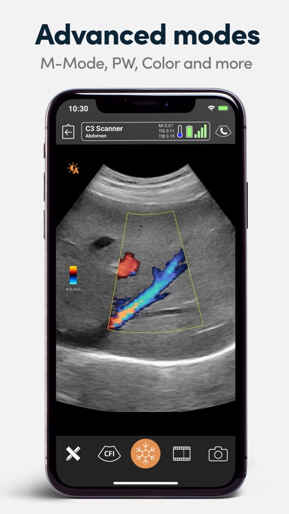 Clarius Ultrasound App screenshot-3