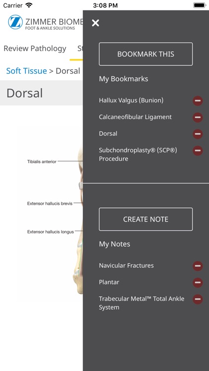 Foot & Ankle - Zimmer Biomet screenshot-3