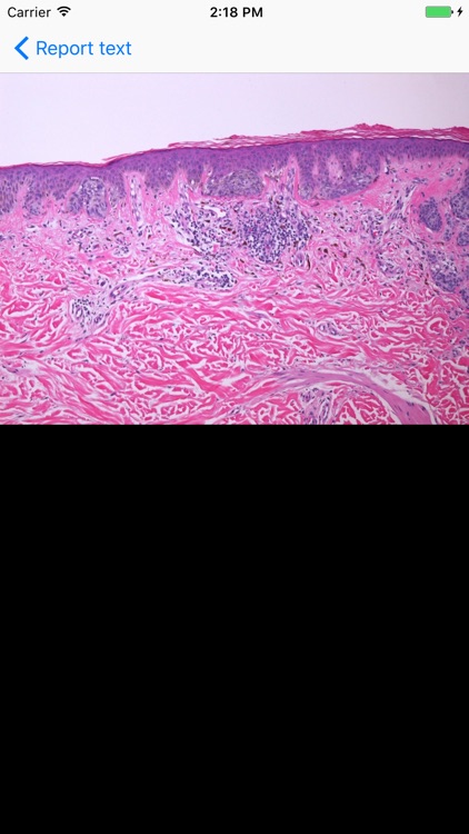 iDermpath