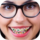 Braces on teeth – Photo editor orthodontic