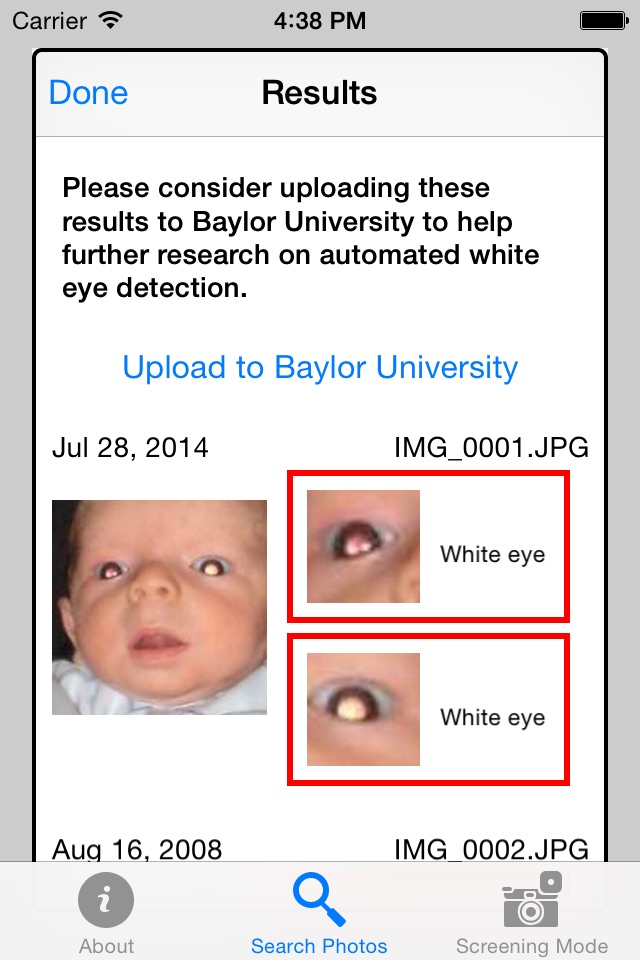 CRADLE White Eye Detector screenshot 4