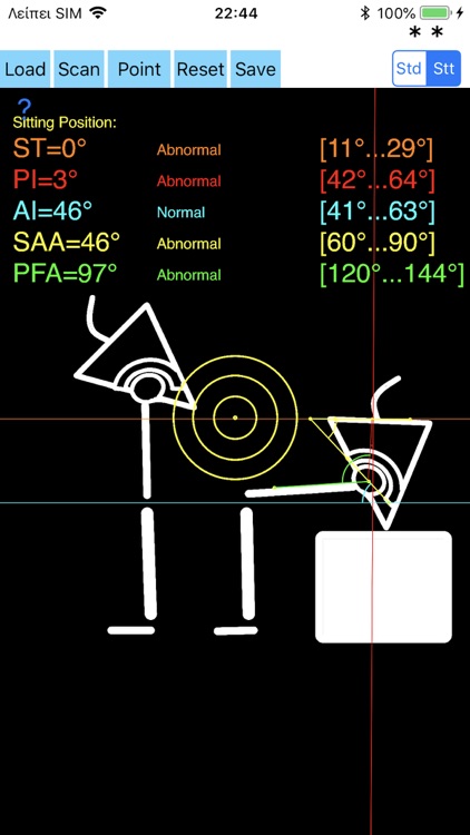 SpinopelvicMobilityApp screenshot-6