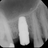 Dental ML pour PC