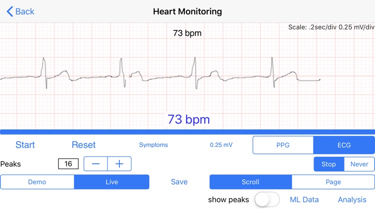 EverBeat-Daily Heart Health