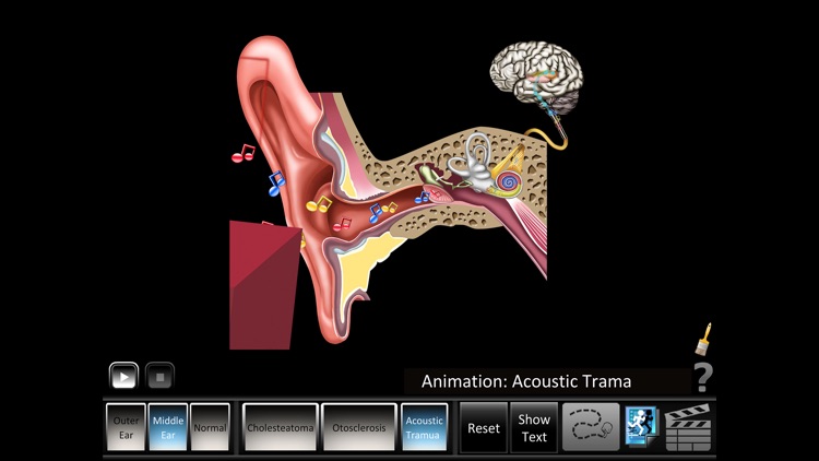 Ear Disorders: Outer Middle