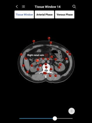 Screenshot 9 MedImaging-Radiology Made Easy iphone