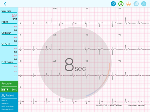 QT ECG screenshot 3