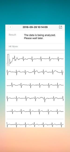 CAREWELL AI-ECG(圖4)-速報App