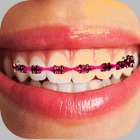 Top 39 Photo & Video Apps Like Braces Photo Editor - Stickers - Best Alternatives