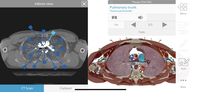 Human Anatomy Atlas 2019(圖4)-速報App