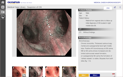 BronchoCases screenshot 3