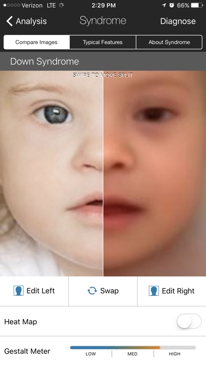 Face2Gene