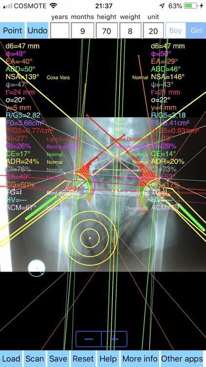 PapadimitriouAbductionSplint