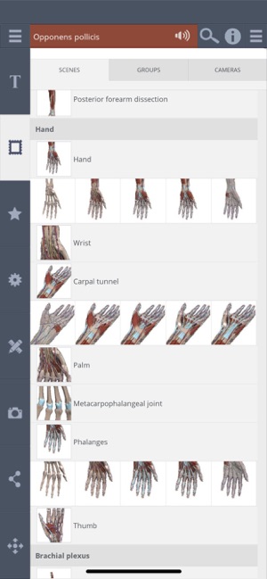 Forearm & Hand: 3D Real-time(圖2)-速報App