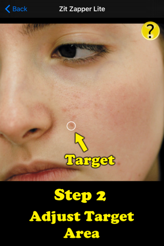 Zit Zapper - Remove Pimples screenshot 3