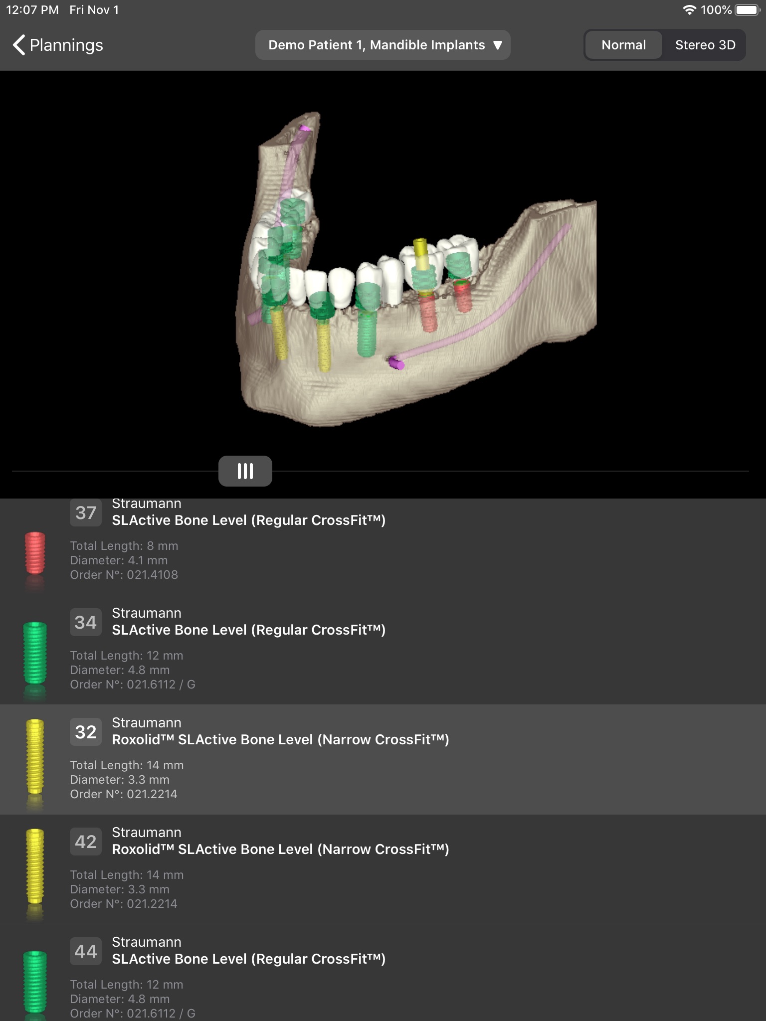 coDiagnostiX screenshot 3