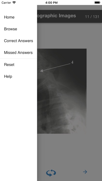 Rad Tech - Radiographic Images screenshot-3