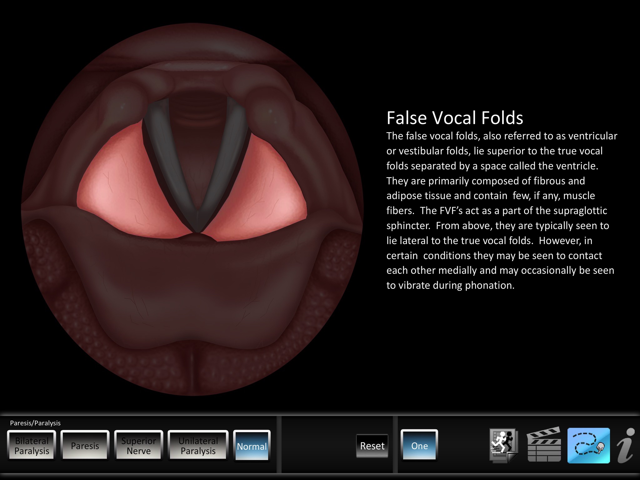 Paresis/Paralysis screenshot 4