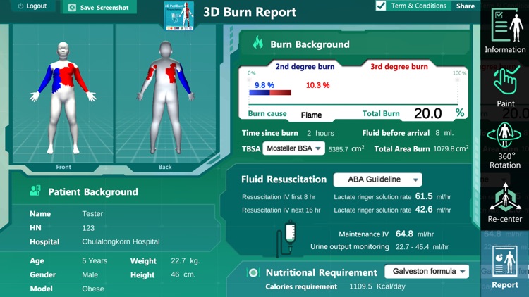 3D PED Burn Resuscitation