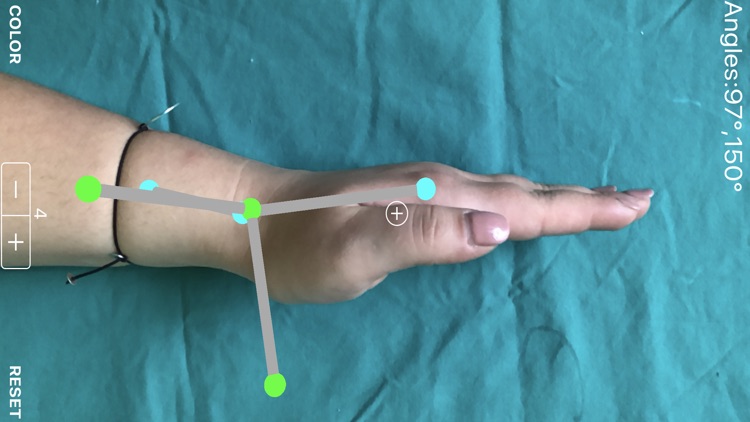 ARorthopaedicGoniometer screenshot-7