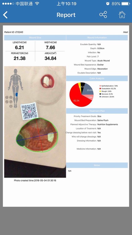 WoundDoc2