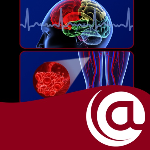 Stroke Prevention in AFib @PoC
