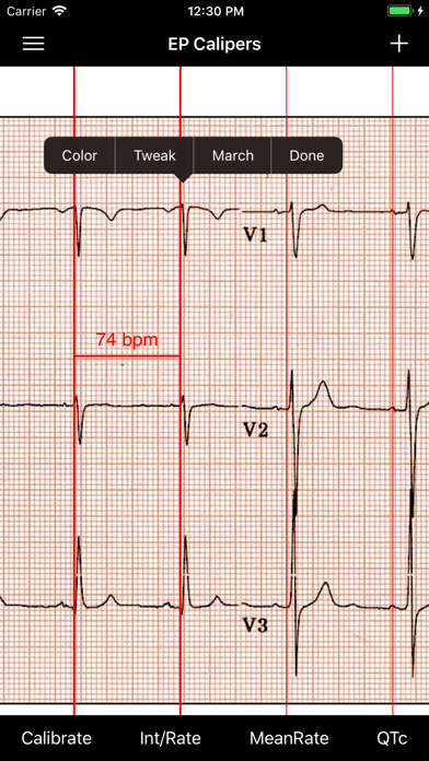 EP Calipers Screenshot 3