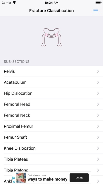 Fracture Classification (FC) screenshot-4