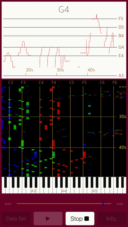 Vocalise Scope