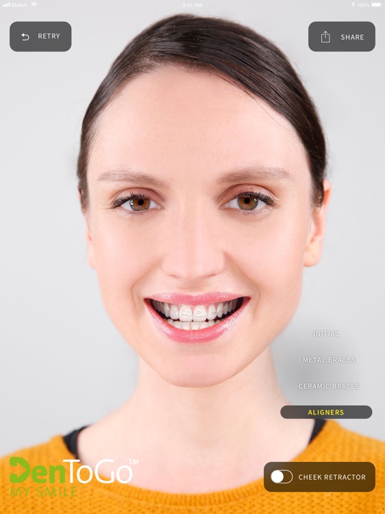 MySmile by Straumann screenshot-3