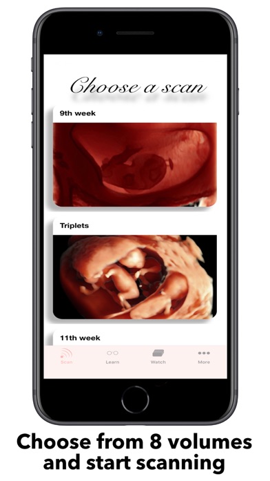 ScanBaby learn baby ultrasound screenshot 3