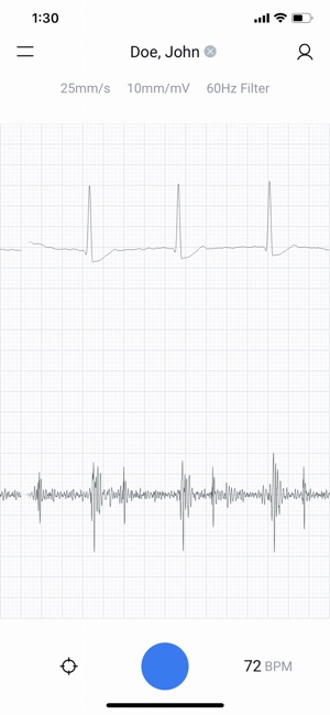 Eko: Digital Stethoscope + ECG(圖2)-速報App