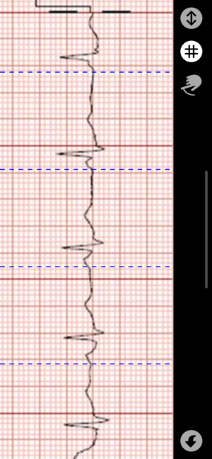 ECG Caliper(圖5)-速報App