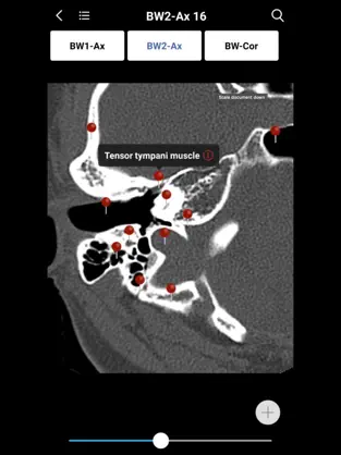 Imágen 4 MedImaging-Radiology Made Easy iphone