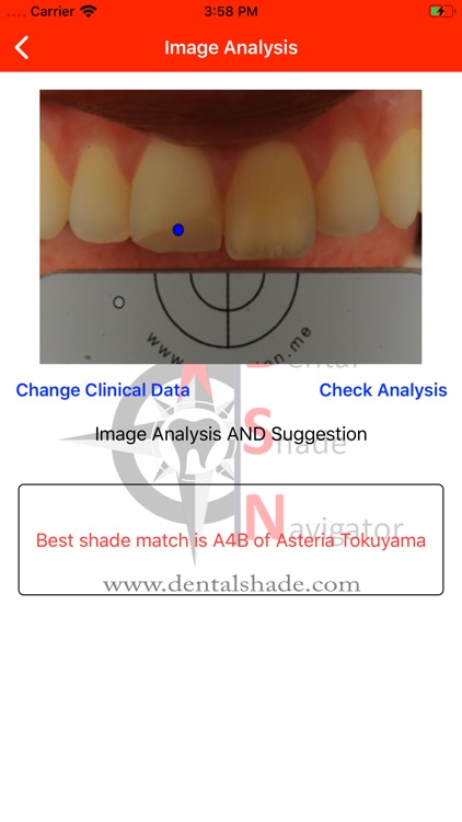 Dental Shade Navigator