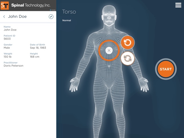 SpinalTech3D Scan(圖3)-速報App