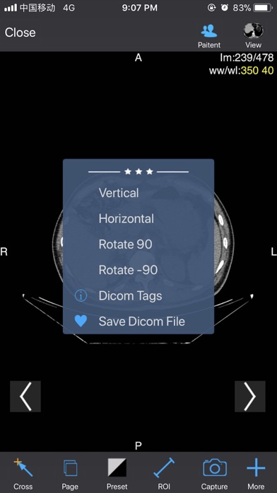 Dicom3D - Easy and Powerful screenshot 4