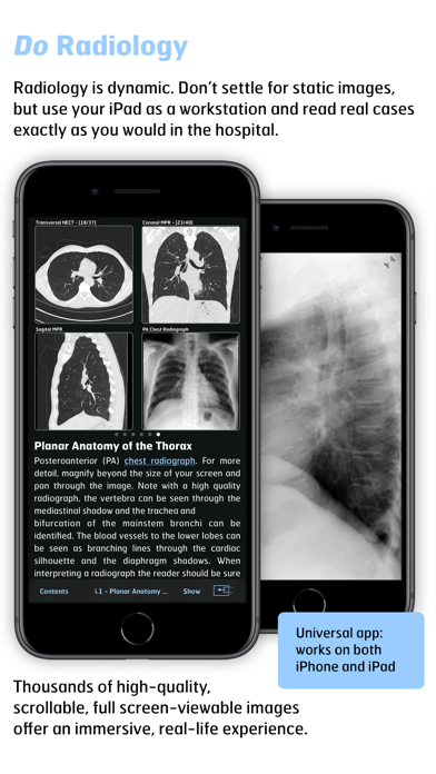 How to cancel & delete Radiology - Thoracic Imaging from iphone & ipad 3