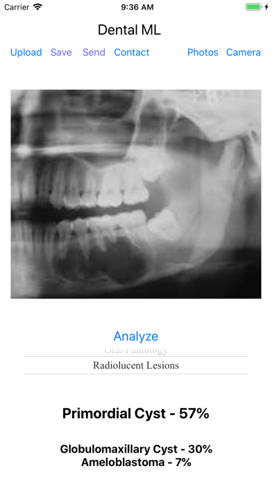 Dental ML screenshot 4