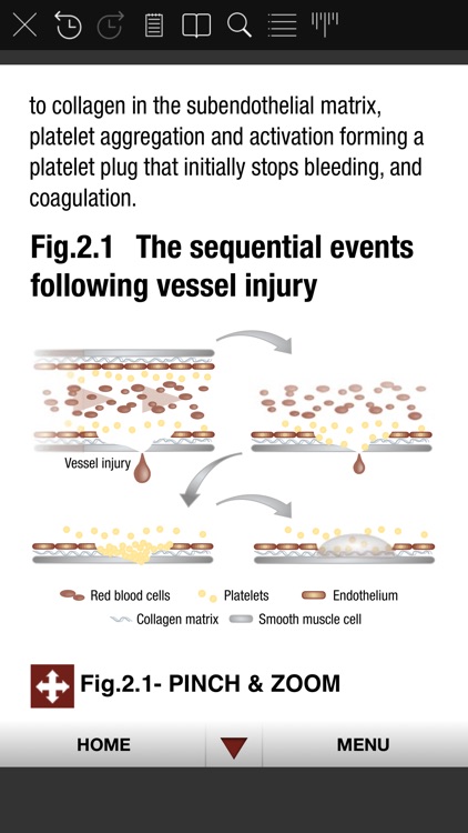 Antithrombotic Therapy