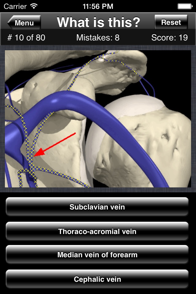 Anatomy Shoulder Quiz screenshot 3