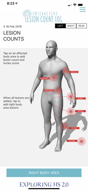 Hs Lesion Counts(圖2)-速報App