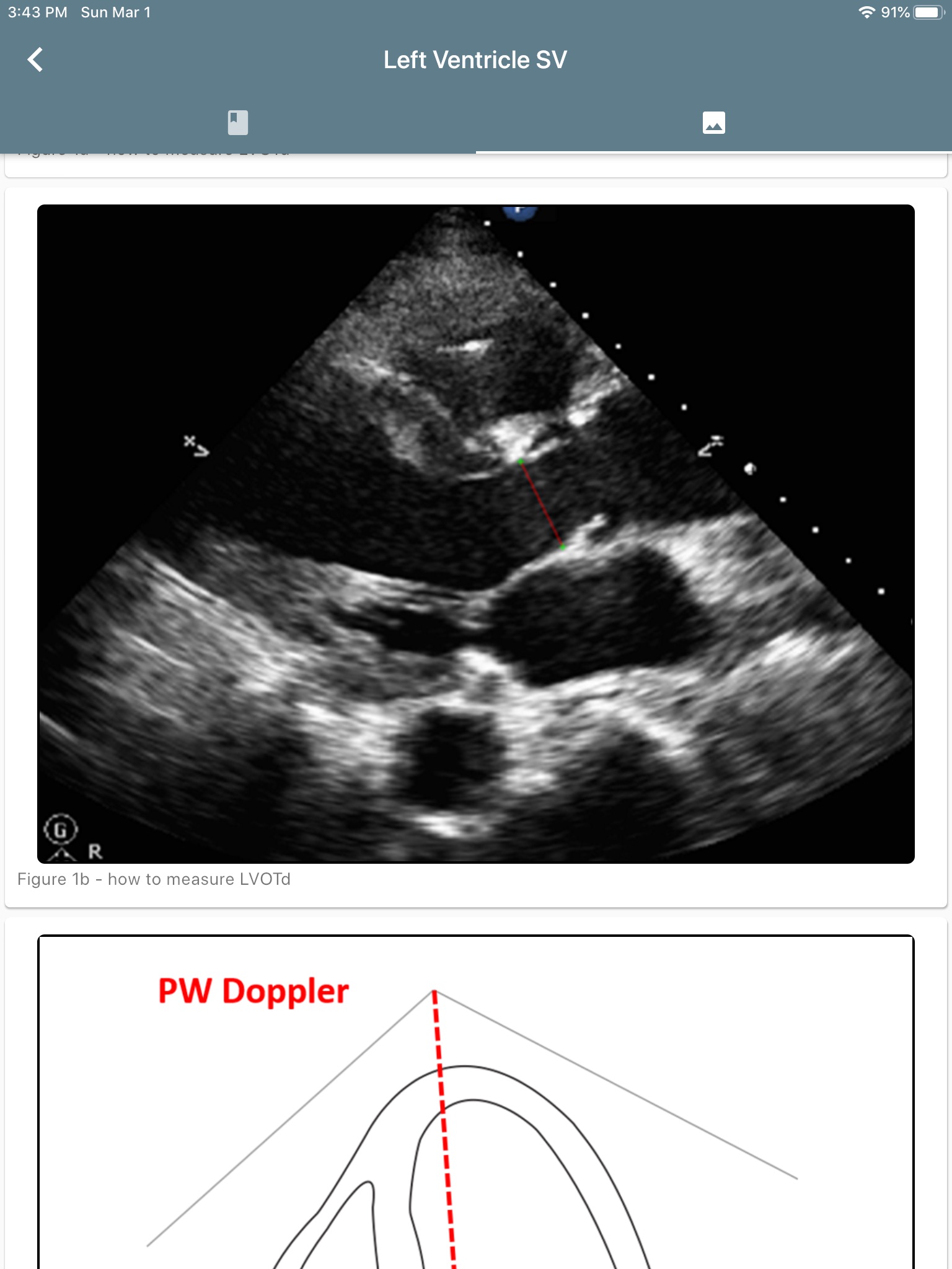 Resuscitation Ultrasound screenshot 4