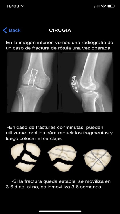 Rodilla App screenshot-6