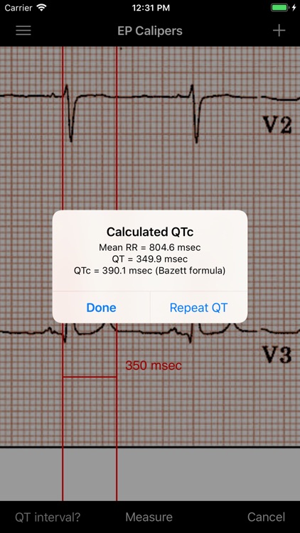 EP Calipers screenshot-3