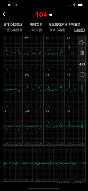 ECG / EKG(圖3)-速報App