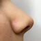 This app enables users to keep record of the state of their nostrils
