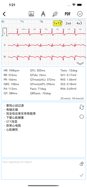 ECG / EKG(圖5)-速報App